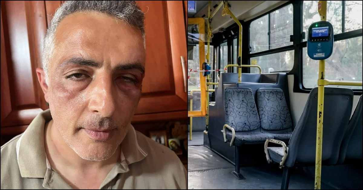 Δυο Πακιστανοί και ένας Αλβανός ξυλοκόπησαν και δάγκωσαν ελεγκτή λεωφορείου επειδή τόλμησε να τους ελέγξει